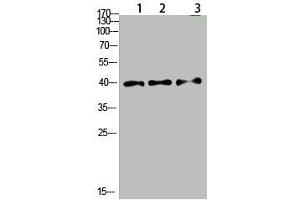 Western Blot analysis of 1,mouse-lung 2,mouse-brain 3,mouse-spleen cells using primary antibody diluted at 1:500(4 °C overnight). (Tropomyosin Antikörper  (AA 101-150))