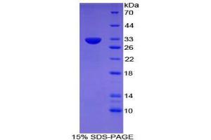 SDS-PAGE (SDS) image for CD109 (CD109) (AA 890-1131) protein (His tag) (ABIN1879069) (CD109 Protein (CD109) (AA 890-1131) (His tag))
