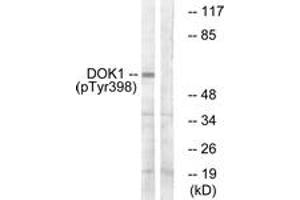 Western blot analysis of extracts from K562 cells treated with Starvation 24h, using p62 Dok (Phospho-Tyr398) Antibody. (DOK1 Antikörper  (pTyr398))