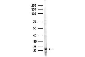 Western blot analysis of lysates from A2780 cells(starvation 24h treatment), using MRPS28 Antibody at 1/1000 dilution.