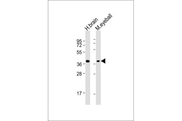 ARR3 Antikörper  (AA 77-109)