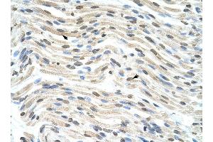 THOC3 antibody was used for immunohistochemistry at a concentration of 4-8 ug/ml to stain Myocardial cells (arrows) in Human Heart. (THO Complex 3 Antikörper  (Middle Region))