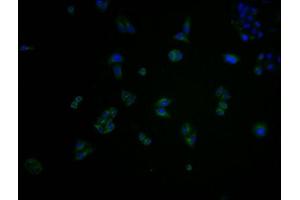 Immunofluorescence staining of Hela cells with ABIN7148898 at 1:100, counter-stained with DAPI. (CDK6 Antikörper  (AA 102-326))