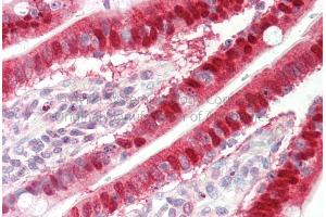 Immunohistochemistry (IHC) image for anti-Sulfotransferase Family, Cytosolic, 1A, Phenol-Preferring, Member 1 (SULT1A1) (N-Term) antibody (ABIN2783656)