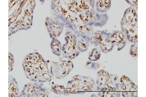 Immunostaining (ISt) image for anti-Fc Fragment of IgG, Low Affinity IIb, Receptor (CD32) (FCGR2B) (AA 45-154) antibody (ABIN560858)