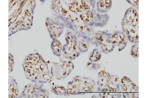 Immunoperoxidase of monoclonal antibody to FCGR2B on formalin-fixed paraffin-embedded human placenta. (FCGR2B Antikörper  (AA 45-154))