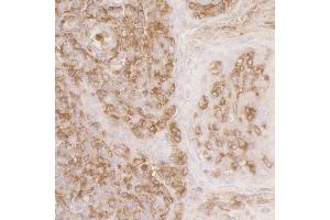 Immunohistochemistry (IHC) image for anti-Actin-Related Protein 2 (ACTR2) (AA 25-75) antibody (ABIN7453417) (ACTR2 Antikörper  (AA 25-75))