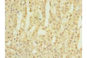 Immunohistochemistry of paraffin-embedded human adrenal gland tissue using ABIN7145628 at dilution of 1:100 (LOH12CR1 Antikörper  (AA 1-196))