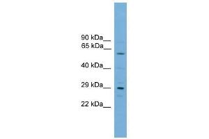Western Blot showing RPAIN antibody used at a concentration of 1-2 ug/ml to detect its target protein. (RPAIN Antikörper  (C-Term))