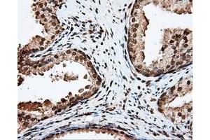 Immunohistochemical staining of paraffin-embedded liver tissue using anti-APP mouse monoclonal antibody. (APP Antikörper)
