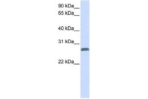 TMEM51 antibody used at 1 ug/ml to detect target protein. (TMEM51 Antikörper  (N-Term))