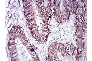 Immunohistochemistry (IHC) image for anti-LI Cadherin (AA 600-707) antibody (ABIN5542556)