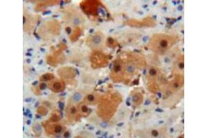 Used in DAB staining on fromalin fixed paraffin-embedded Liver tissue (IGF1 Antikörper  (AA 48-118))