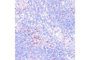 Immunohistochemistry of paraffin-embedded mouse spleen using Zyxinin antibody (ABIN3023008, ABIN3023009, ABIN3023010 and ABIN6219343) at dilution of 1:100 (40x lens). (ZYX Antikörper  (AA 1-300))