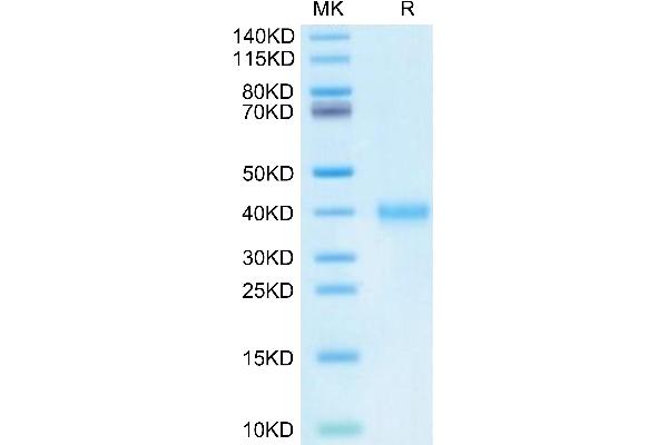 IGSF11 Protein (AA 23-240) (His tag)