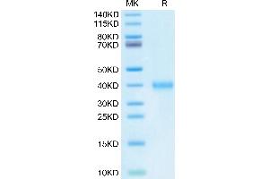 IGSF11 Protein (AA 23-240) (His tag)