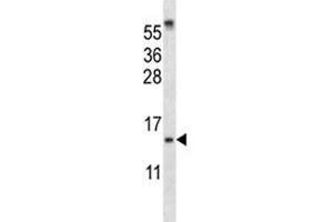 SUMO-1 antibody western blot analysis in ZR-75-1 lysate (SUMO1 Antikörper  (AA 1-30))