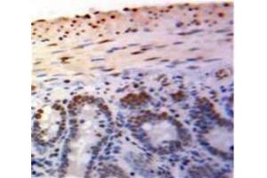Used in DAB staining on fromalin fixed paraffin-embedded Bowels tissue (PML Antikörper  (AA 59-239))