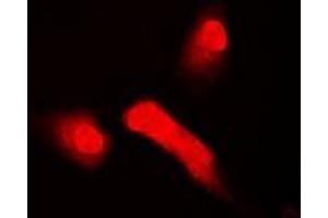 Immunofluorescent analysis of HOS staining in A549 cells. (T-Box 5 Antikörper)