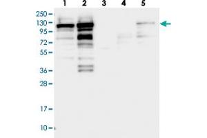 Western blot analysis of Lane 1: RT-4, Lane 2: U-251 MG, Lane 3: Human Plasma, Lane 4: Liver, Lane 5: Tonsil with SH3PXD2B polyclonal antibody . (SH3PXD2B Antikörper)