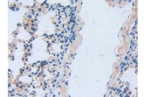Immunohistochemistry (IHC) image for anti-Lipocalin 6 (LCN6) (AA 28-187) antibody (ABIN7443488)