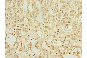 Immunohistochemistry of paraffin-embedded human adrenal gland tissue using ABIN7154963 at dilution of 1:100 (HEMK1 Antikörper  (AA 1-338))