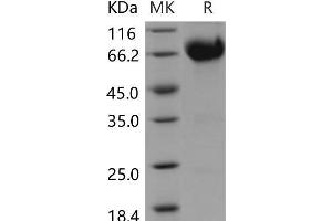 Western Blotting (WB) image for Interleukin 10 Receptor, beta (IL10RB) protein (Fc Tag) (ABIN7196362) (IL10RB Protein (Fc Tag))