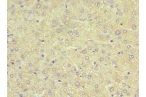 Immunohistochemistry of paraffin-embedded human liver tissue using ABIN7170334 at dilution of 1:100 (SRI Antikörper  (AA 1-198))