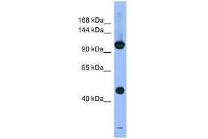 WB Suggested Anti-PSMD1 Antibody Titration: 0. (PSMD1 Antikörper  (N-Term))