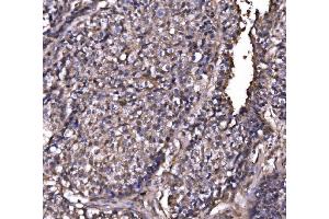 IHC analysis of EXOSC3 using anti-EXOSC3 antibody (ABIN7602216). (EXOSC3 Antikörper  (AA 64-275))