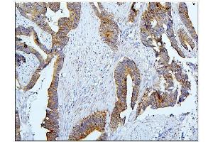 IHC analysis of BubR1/BUB1B using anti-BubR1/BUB1B antibody (ABIN7600962). (BUB1B Antikörper  (AA 26-448))