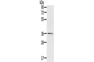 Western Blotting (WB) image for anti-Ring Finger Protein 144B (RNF144B) antibody (ABIN2430277) (RNF144B Antikörper)