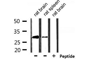 Western blot analysis of extracts from rat brain and rat spleen, using Hes1 Antibody. (HES1 Antikörper  (Internal Region))