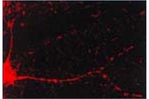 Immunofluorescence (IF) image for anti-Calcium/calmodulin-Dependent Protein Kinase II alpha (CAMK2A) antibody (ABIN492419) (CAMK2A Antikörper)