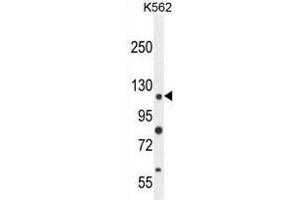 ANR52 Antibody (N-term) western blot analysis in K562 cell line lysates (35µg/lane). (ANKRD52 Antikörper  (N-Term))