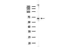 Western blot analysis of lysates from Mouse liver, using AIFM1 Antibody at 1/1000 dilution.