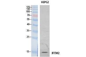 Western Blotting (WB) image for anti-Interferon Induced Transmembrane Protein 2 (IFITM2) (Internal Region) antibody (ABIN3187997) (IFITM2 Antikörper  (Internal Region))