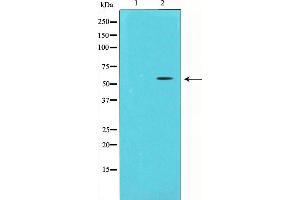Western blot analysis of Chk1 expression in HeLa whole cell lysates,The lane on the left is treated with the antigen-specific peptide. (CHEK1 Antikörper  (Internal Region))