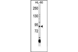 Western blot analysis of DNMT3A Antibody (Center) in HL-60 cell line lysates (35ug/lane).