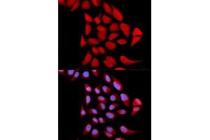 Immunofluorescence analysis of U2OS cells using PSMA6 antibody. (PSMA6 Antikörper  (AA 1-246))