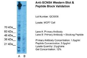 Western Blotting (WB) image for anti-Sodium Channel, Voltage-Gated, Type V, alpha Subunit (SCN5A) (C-Term) antibody (ABIN2776347)