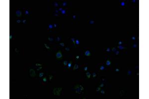 ImmunofluorescencestainingofPC3cellswithABIN7162195at1:100,counter-stainedwithDAPI. (OR9G1 Antikörper  (AA 290-304))