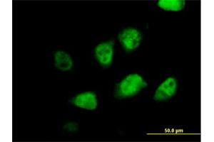 Immunofluorescence of purified MaxPab antibody to MLF2 on HeLa cell. (MLF2 Antikörper  (AA 1-248))