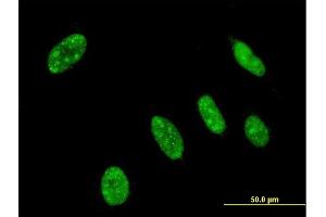 Immunofluorescence of monoclonal antibody to NEUROG3 on HeLa cell.