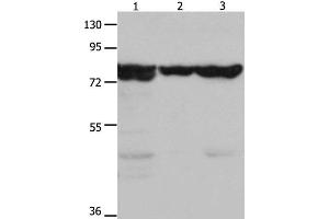 Western Blot analysis of Mouse kidney tissue, 293T and hela cell using HSP75 Polyclonal Antibody at dilution of 1:1500 (TRAP1 Antikörper)