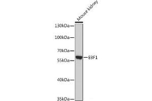 Western blot analysis of extracts of Mouse kidney using EBF1 Polyclonal Antibody at dilution of 1:1000. (EBF1 Antikörper)