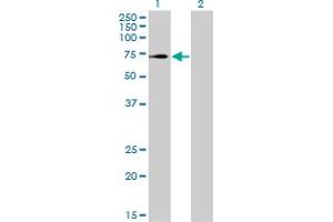 Western Blot analysis of TRIM32 expression in transfected 293T cell line by TRIM32 monoclonal antibody (M09), clone 2E5.