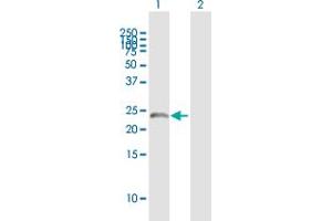 Western Blotting (WB) image for anti-Squamous Cell Carcinoma Antigen Recognized By T Cells 3 (SART3) (AA 1-129) antibody (ABIN2752437)