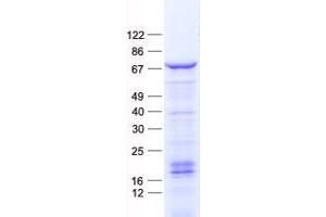 Western Blotting (WB) image for Forkhead Box C2 (MFH-1, Mesenchyme Forkhead 1) (FOXC2) protein (His tag) (ABIN2721344)