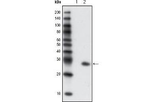 Western blot analysis using GFP mouse mAb against extracts from HCC827 cells, untransfected (1) and transfected with GFP(2). (GFP Antikörper)